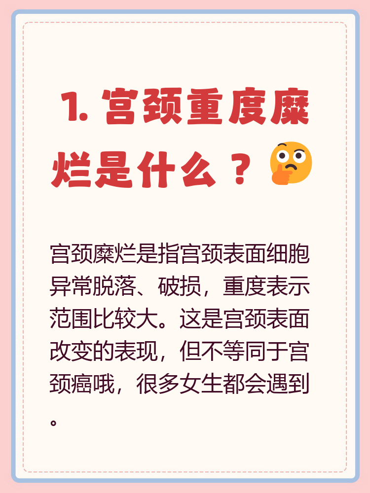 改变指的是什么